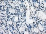 LTA4H Antibody in Immunohistochemistry (Paraffin) (IHC (P))
