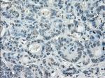 LTA4H Antibody in Immunohistochemistry (Paraffin) (IHC (P))