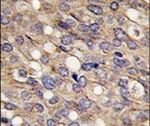 LTBP1 Antibody in Immunohistochemistry (IHC)