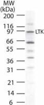 LTK Antibody in Western Blot (WB)