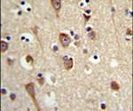 LUC7L2 Antibody in Immunohistochemistry (IHC)
