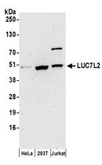 LUC7L2 Polyclonal Antibody