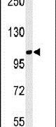LUZP1 Antibody in Western Blot (WB)