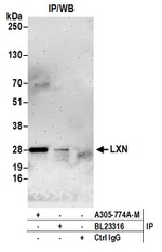 LXN Polyclonal Antibody