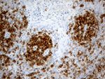 LY9 Antibody in Immunohistochemistry (Paraffin) (IHC (P))
