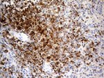 LY9 Antibody in Immunohistochemistry (Paraffin) (IHC (P))