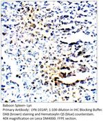 Lyn Polyclonal Antibody