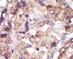 Lyn Antibody in Immunohistochemistry (IHC)