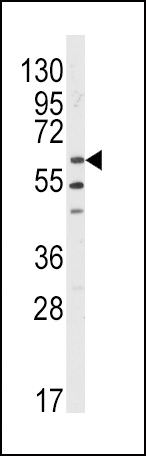 Lyn Antibody in Western Blot (WB)