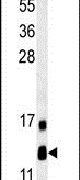 LYRM2 Antibody in Western Blot (WB)