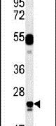 LYSMD1 Antibody in Western Blot (WB)