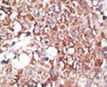 LYVE1 Antibody in Immunohistochemistry (IHC)