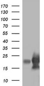 LYZ Antibody in Western Blot (WB)