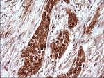 LZIC Antibody in Immunohistochemistry (Paraffin) (IHC (P))