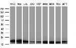 LZIC Antibody in Western Blot (WB)