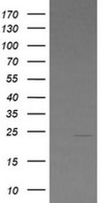 LZIC Antibody in Western Blot (WB)