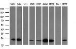 LZIC Antibody in Western Blot (WB)