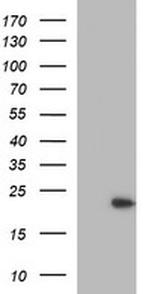 LZIC Antibody in Western Blot (WB)