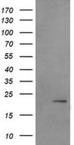 LZIC Antibody in Western Blot (WB)