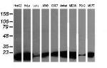 LZIC Antibody in Western Blot (WB)