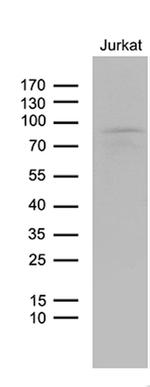 LZTS1 Antibody in Western Blot (WB)