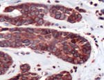 Lamin B1 Antibody in Immunohistochemistry (IHC)