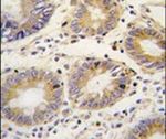 LEFTY Antibody in Immunohistochemistry (IHC)