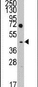 LEFTY Antibody in Western Blot (WB)
