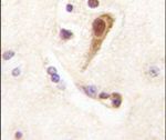 LHX6 Antibody in Immunohistochemistry (IHC)