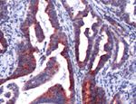NGAL Antibody in Immunohistochemistry (IHC)