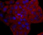 Cytokeratin 17 Antibody in Immunocytochemistry (ICC/IF)