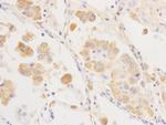 Cytokeratin 18 Antibody in Immunohistochemistry (Paraffin) (IHC (P))