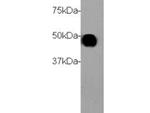 Cytokeratin 18 Antibody in Western Blot (WB)