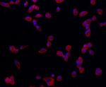 Synaptophysin Antibody in Immunocytochemistry (ICC/IF)