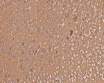 Synaptophysin Antibody in Immunohistochemistry (Paraffin) (IHC (P))