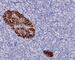 Synaptophysin Antibody in Immunohistochemistry (Paraffin) (IHC (P))