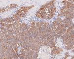 Synaptophysin Antibody in Immunohistochemistry (Paraffin) (IHC (P))