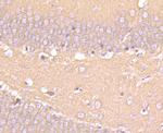 Beta III Tubulin Antibody in Immunohistochemistry (Paraffin) (IHC (P))