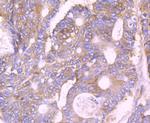 Beta III Tubulin Antibody in Immunohistochemistry (Paraffin) (IHC (P))