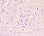 Beta III Tubulin Antibody in Immunohistochemistry (Paraffin) (IHC (P))