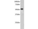 Beta III Tubulin Antibody in Western Blot (WB)