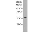 TdT Antibody in Western Blot (WB)