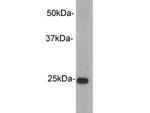 Rabbit IgG Kappa Light Chain Antibody in Western Blot (WB)