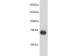 Human Serum Albumin Antibody in Western Blot (WB)
