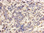 HSP60 Antibody in Immunohistochemistry (Paraffin) (IHC (P))