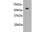 HA Tag Antibody in Western Blot (WB)