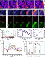 mCherry Antibody in Immunocytochemistry (ICC/IF)