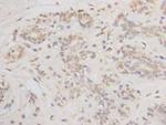 Bcl-2 Antibody in Immunohistochemistry (Paraffin) (IHC (P))