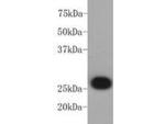 Bcl-2 Antibody in Western Blot (WB)