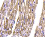 Cardiac Troponin T Antibody in Immunohistochemistry (Paraffin) (IHC (P))
